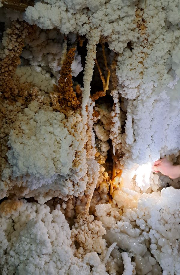 wtórna mineralizacja soli w postaci kalafiorowatych nacieków